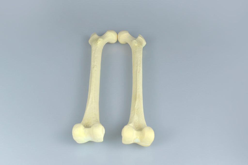 left and right femur tibia – Jojenmed Inc. Best Education model China ...